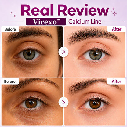 🔥LAST DAY 50% OFF!! Virexo Korean Calcium Dark Spot Eye Cream