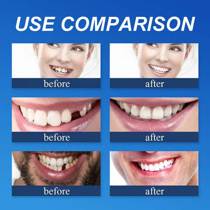 🎁 LUMIVO™ Premium Denture Set – Upper & Lower Dentures